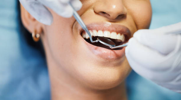 Best Emergency Wisdom Tooth Extraction in Coudersport, PA