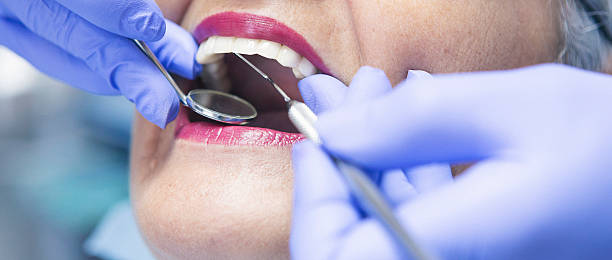 Best Emergency Dental Care for Sports Injuries in Coudersport, PA